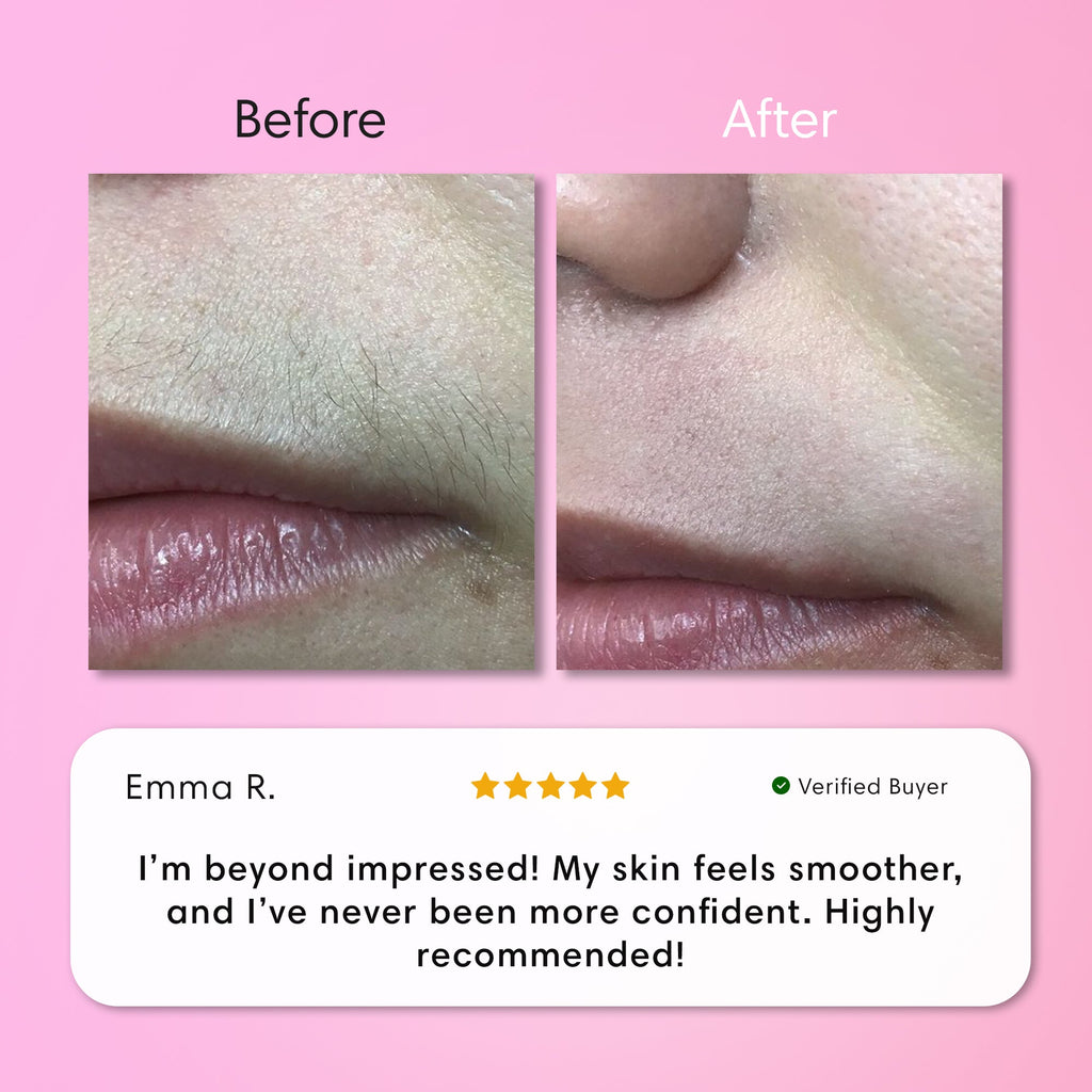 Instant Hair Removal Kit